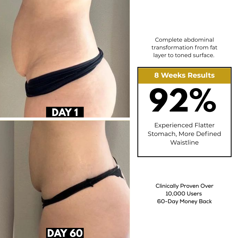 K-Sculpt™ Pro 4-in-1 Body Contouring System