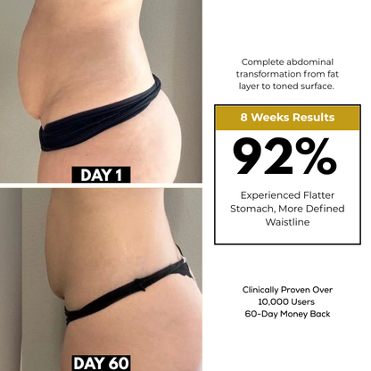 K-Sculpt™ Pro 4-in-1 Body Contouring System