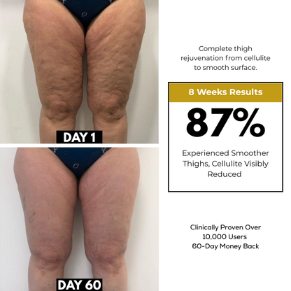 K-Sculpt™ Pro 4-in-1 Body Contouring System